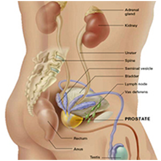 Prostate cancer treatment in India